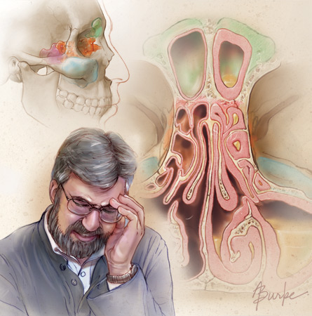 Montage illustration of sinuses and headache © AMA